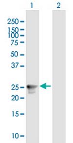 RAB33A Polyclonal Antibody, MaxPab™
