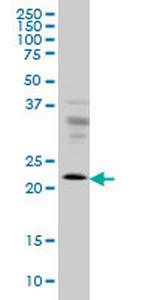 RAB9A Monoclonal Antibody (1E12)