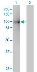 KIF3B Monoclonal Antibody (8H4)