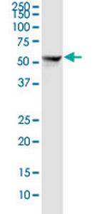 SLC22A8 Monoclonal Antibody (3C11)