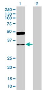 GRHPR Polyclonal Antibody, MaxPab™