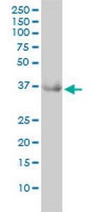 GRHPR Monoclonal Antibody (4E6-1F2)