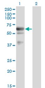 LIPG Monoclonal Antibody (1E11)