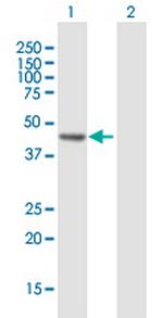 RECQL5 Antibody in Western Blot (WB)