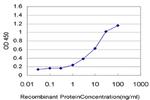 SURB7 Antibody in ELISA (ELISA)