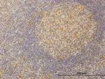 SURB7 Antibody in Immunohistochemistry (Paraffin) (IHC (P))