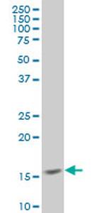 SURB7 Antibody in Western Blot (WB)
