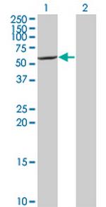 CYP7B1 Monoclonal Antibody (2B11)
