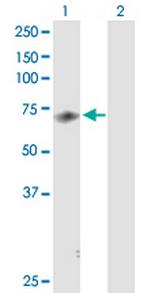 MED26 Antibody in Western Blot (WB)