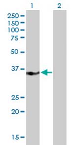 MED27 Antibody in Western Blot (WB)