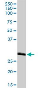 MED27 Antibody in Western Blot (WB)