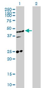 MED27 Polyclonal Antibody, MaxPab™