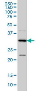 CRSP8 Monoclonal Antibody (8B8)