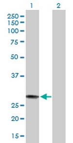 MED7 Antibody in Western Blot (WB)
