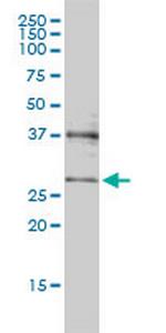 CRSP9 Antibody in Western Blot (WB)