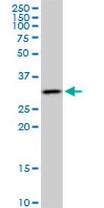 CRSP9 Antibody in Western Blot (WB)