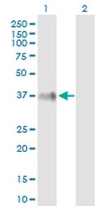 ITM2B Polyclonal Antibody, MaxPab™