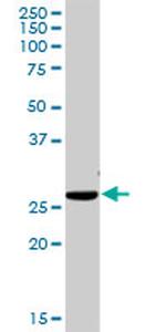 ITM2B Antibody in Western Blot (WB)