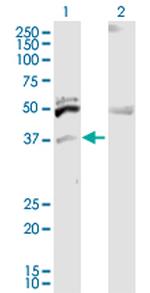 ITM2B Polyclonal Antibody, MaxPab™