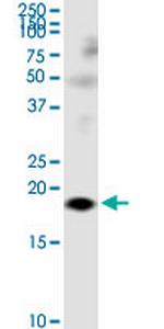 LY86 Monoclonal Antibody (1H3)