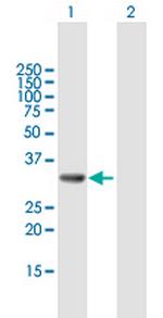 GGPS1 Polyclonal Antibody, MaxPab™