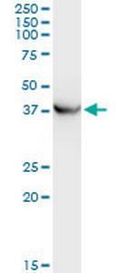 PRKCABP Monoclonal Antibody (3G5)