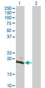 HAND2 Monoclonal Antibody (4D9)