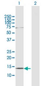 AKAP7 Antibody in Western Blot (WB)