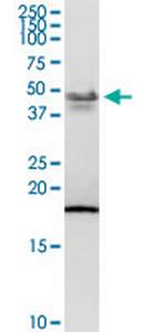 PCYT1B Polyclonal Antibody, MaxPab™