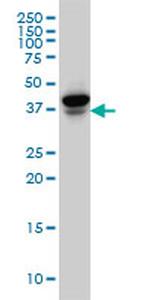 EIF4E2 Monoclonal Antibody (1A11)