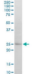 ATG5 Monoclonal Antibody (1G11)