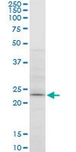 ATG5 Monoclonal Antibody (1E7)