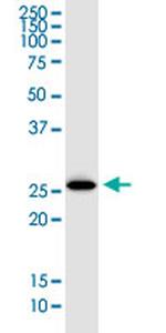 ATG5 Monoclonal Antibody (2G3)