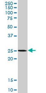 ATG5 Antibody in Western Blot (WB)