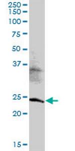 MED20 Polyclonal Antibody, MaxPab™