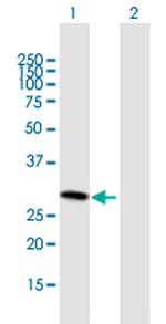 SLC25A27 Polyclonal Antibody, MaxPab™