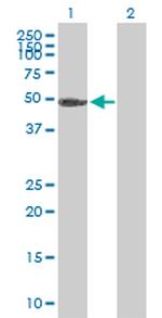 PGS1 Polyclonal Antibody, MaxPab™