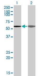 AKAP5 Monoclonal Antibody (1A9)