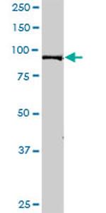 MAGED1 Antibody in Western Blot (WB)