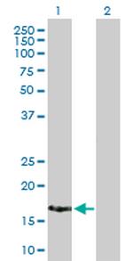 XAGE2 Antibody in Western Blot (WB)