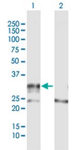 ADAMTS4 Polyclonal Antibody, MaxPab™