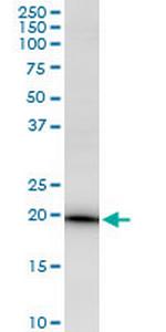 EEF1E1 Polyclonal Antibody, MaxPab™
