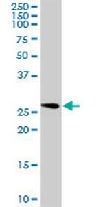 GOSR1 Antibody in Western Blot (WB)