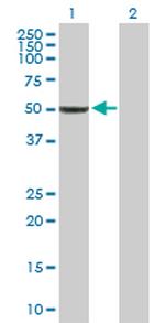 BAG5 Polyclonal Antibody, MaxPab™