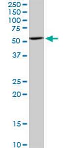 BAG5 Monoclonal Antibody (1E3)