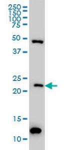 BAG2 Monoclonal Antibody (6E12)
