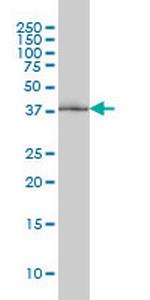 POLR1C Monoclonal Antibody (3A5-H2)