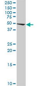 CIR Monoclonal Antibody (2E11)