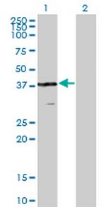 VPS26A Monoclonal Antibody (1C4)