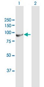 H6PD Polyclonal Antibody, MaxPab™